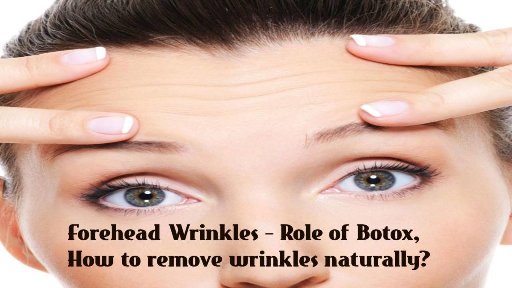 Forehead Wrinkles – Role of Botox, How to remove wrinkles naturally?