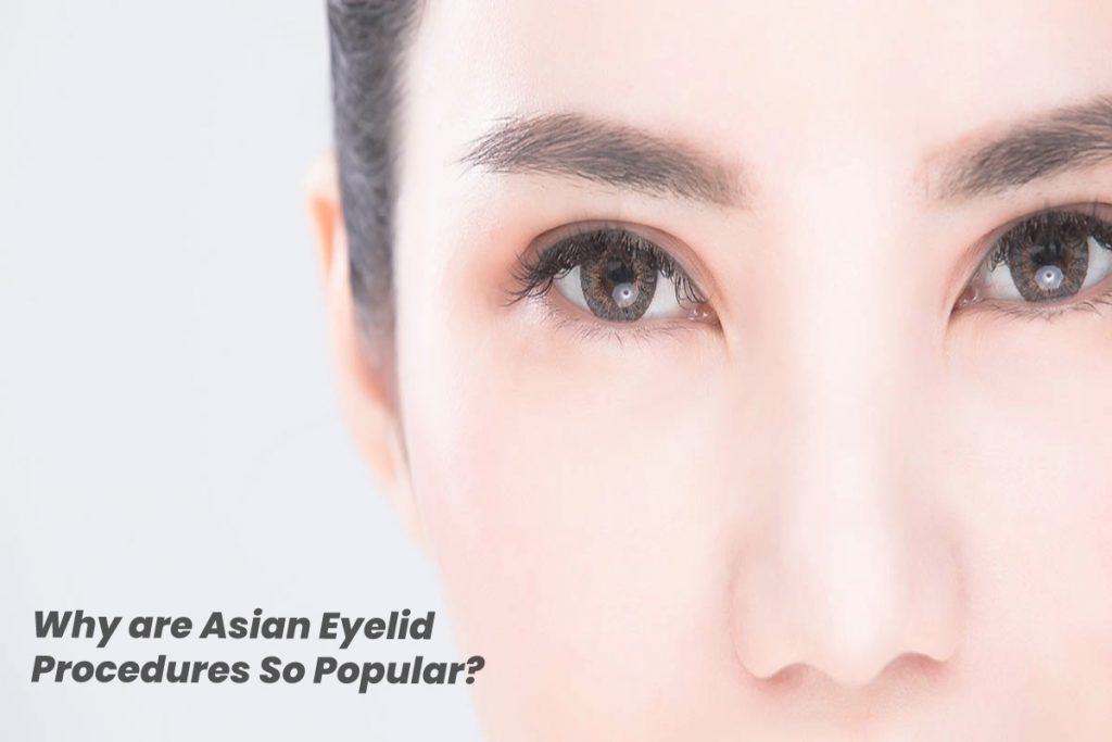 Why are Asian Eyelid Procedures So Popular?