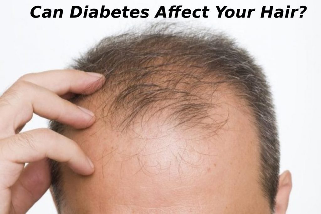 Diabetes Affect Your Hair