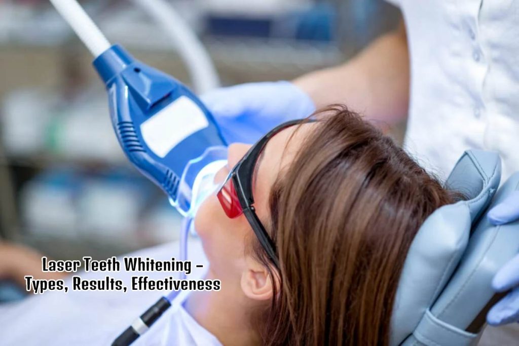 LASER TEETH WHITENING – TYPES, RESULTS, EFFECTIVENESS, PROFESSIONAL METHODS