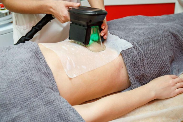 CoolSculpting