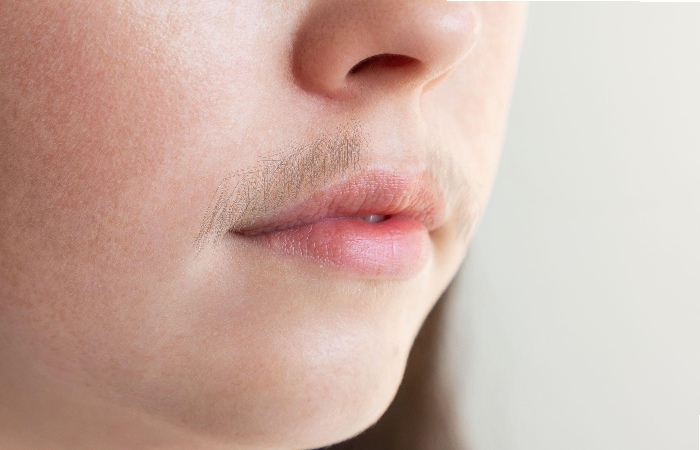 Understanding Upper Lip Hair