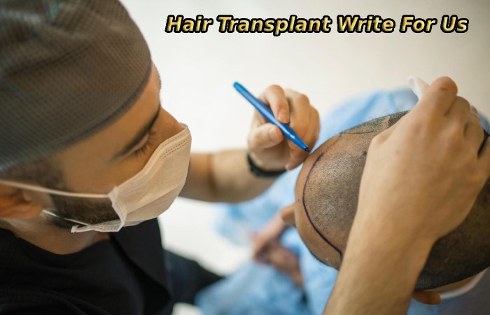 Hair Transplant Write For Us