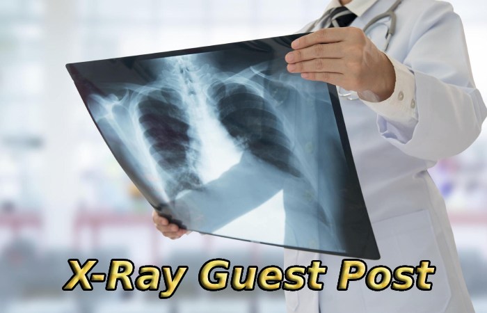 X-Ray Guest Post